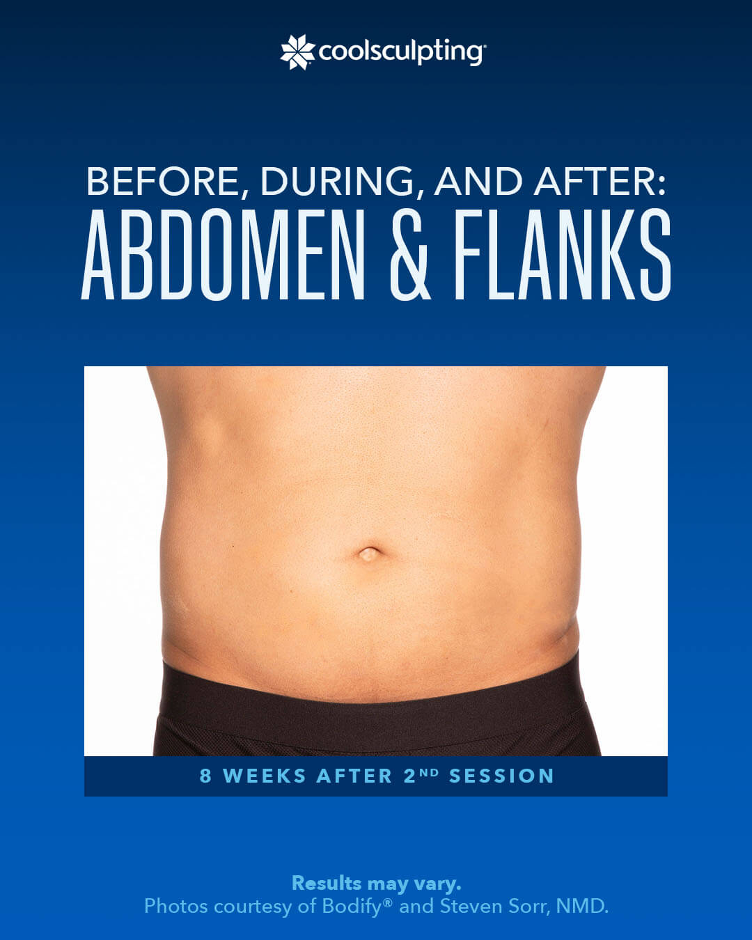 coolsculpting ,Before, During,AND After ABDOMEN $FLANKS