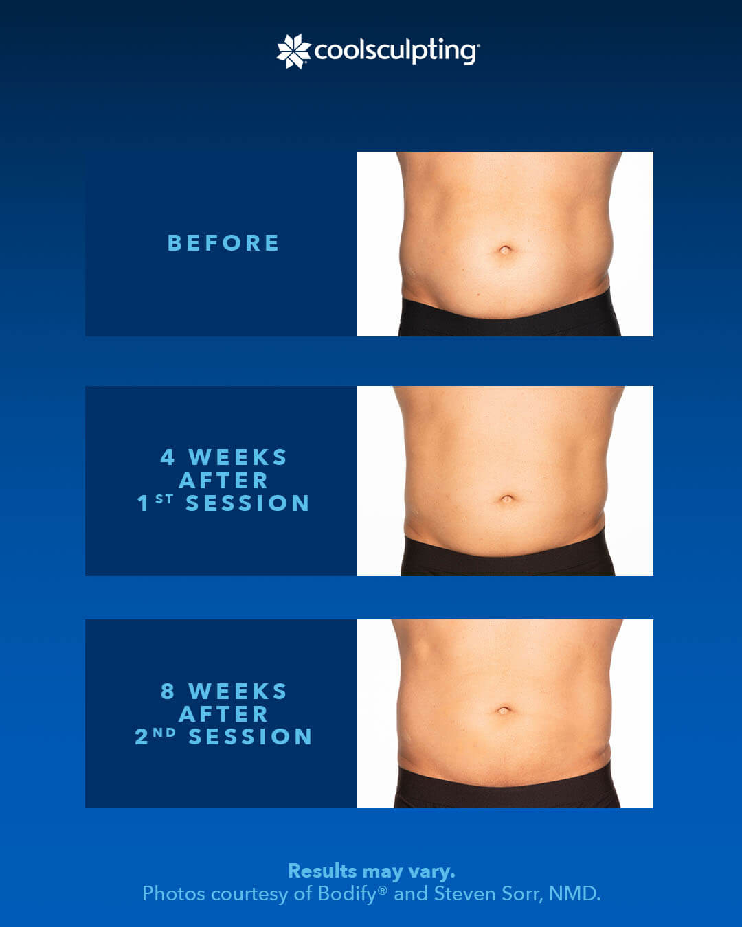 coolsculpting ,Before, During,AND After
