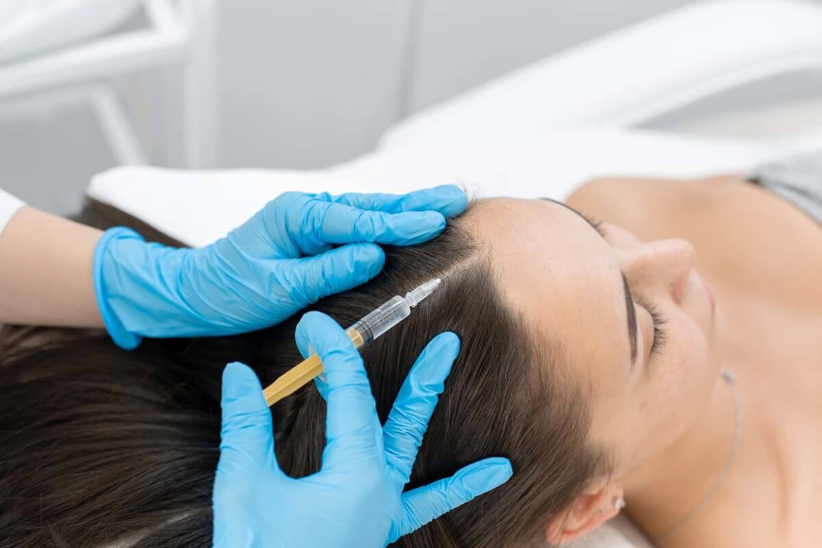 PRP Therapy by Hourglass Aesthetics & Salon in Lexington KY
